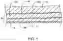 Fig. 02 - Methods and kits for delivering pharmaceutical agents into the coronary vascular adventitia