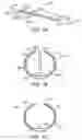 Fig. 03 - Methods and kits for delivering pharmaceutical agents into the coronary vascular adventitia