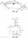 Fig. 04 - Methods and kits for delivering pharmaceutical agents into the coronary vascular adventitia