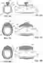 Fig. 07 - Methods and kits for delivering pharmaceutical agents into the coronary vascular adventitia