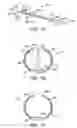 Fig. 03 - Methods and kits for delivering pharmaceutical agents into the coronary vascular adventitia