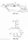 Fig. 04 - Methods and kits for delivering pharmaceutical agents into the coronary vascular adventitia