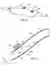 Fig. 06 - Methods and kits for delivering pharmaceutical agents into the coronary vascular adventitia