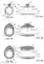 Fig. 07 - Methods and kits for delivering pharmaceutical agents into the coronary vascular adventitia