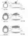 Fig. 07 - Methods and kits for delivering pharmaceutical agents into the coronary vascular adventitia