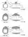 Fig. 07 - Methods and kits for delivering pharmaceutical agents into the coronary vascular adventitia