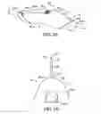 Fig. 04 - Methods and kits for delivering pharmaceutical agents into the coronary vascular adventitia