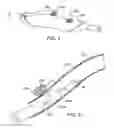 Fig. 06 - Methods and kits for delivering pharmaceutical agents into the coronary vascular adventitia