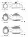 Fig. 07 - Methods and kits for delivering pharmaceutical agents into the coronary vascular adventitia