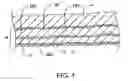 Fig. 02 - Methods and kits for delivering pharmaceutical agents into the coronary vascular adventitia