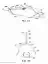 Fig. 04 - Methods and kits for delivering pharmaceutical agents into the coronary vascular adventitia