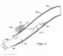 Fig. 05 - Methods and kits for delivering pharmaceutical agents into the coronary vascular adventitia