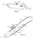 Fig. 06 - Methods and kits for delivering pharmaceutical agents into the coronary vascular adventitia