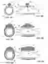 Fig. 07 - Methods and kits for delivering pharmaceutical agents into the coronary vascular adventitia