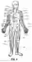 Fig. 06 - Retrograde pressure regulated infusion