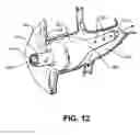 Fig. 10 - Retrograde pressure regulated infusion