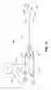 Fig. 13 - Retrograde pressure regulated infusion
