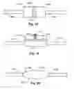 Fig. 16 - Retrograde pressure regulated infusion