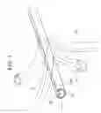 Fig. 04 - Catheter