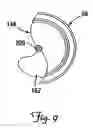 Fig. 09 - Hemostasis seal