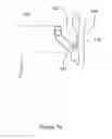Fig. 08 - Disposable, sterile fluid transfer device