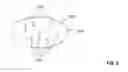Fig. 05 - Remote controller for substance delivery system
