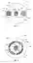 Fig. 02 - Intraocular iontophoretic device and associated methods