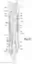 Fig. 17 - Driver assembly and fastener apparatus