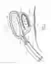 Fig. 03 - Electrosurgical apparatus with fluid flow regulator