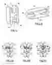 Fig. 03 - Intervertebral implant with two shapes
