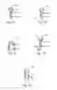 Fig. 13 - Articulating basket with simultaneous basket extension or basket retraction