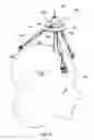 Fig. 17 - Adjustable universal surgical platform