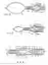 Fig. 04 - Medical ligating apparatus