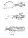 Fig. 04 - Medical ligating apparatus