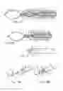 Fig. 07 - Medical ligating apparatus
