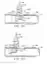 Fig. 08 - Suture cutter