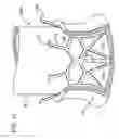 Fig. 12 - Method for Connecting Vessels