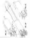 Fig. 02 - Anastomosis apparatus and methods