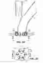 Fig. 07 - Anastomosis apparatus and methods