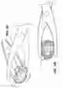 Fig. 11 - Anastomosis apparatus and methods