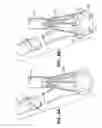 Fig. 13 - Anastomosis apparatus and methods