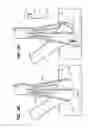 Fig. 15 - Anastomosis apparatus and methods
