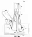 Fig. 25 - Anastomosis apparatus and methods