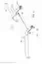 Fig. 05 - Tissue clamp