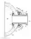 Fig. 01 - Ventricular pump coupling