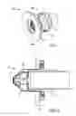 Fig. 02 - Ventricular pump coupling