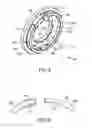 Fig. 06 - Ventricular pump coupling