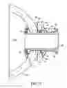 Fig. 09 - Ventricular pump coupling