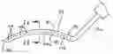 Fig. 01 - SURGICAL INSTRUMENTS AND METHOD FOR CORNEAL REFORMATION