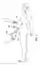 Fig. 02 - Trocars with advanced fixation